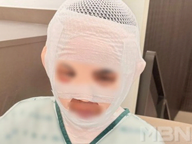 아내에 끓는 물 부은 남편…"딴 남자 만날까봐"라더니 "실수"로 번복 [짤e몽땅] 아내에 끓는 물 부은 남편…″딴 남자 만날까봐″라더니 ″실수... 