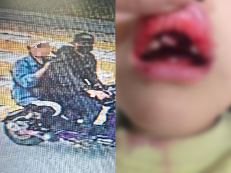 9살 딸 친 보라색 스쿠터 뺑소니범…아빠의 애타는 호소