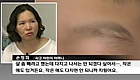어린아이 러닝머신에서 ＇아찔＇ 사고