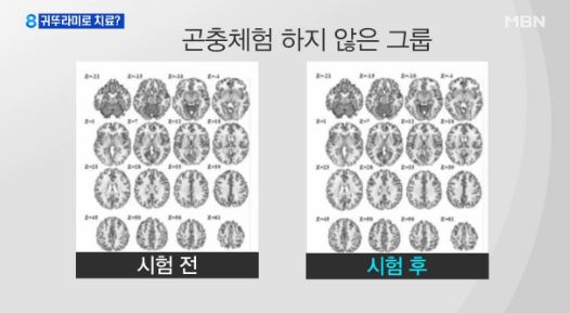 과잉기억증후군이란/사진=MBN