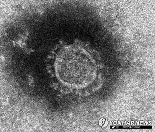 일본 국립감염증 연구소가 분리해 낸 신종 코로나바이러스의 전자현미경 사진 / 사진= 연합뉴스