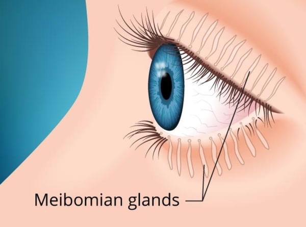 마이봄샘 /사진=아이케어닥터
