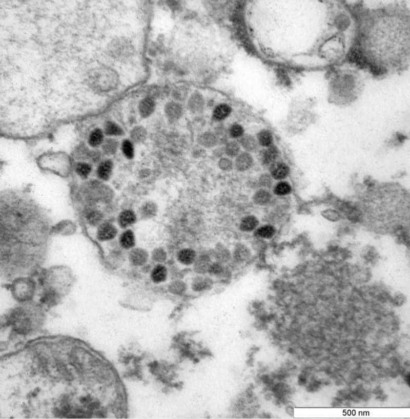 러시아 국립 바이러스·생명공학 연구센터인 '벡토르'가 촬영한 코로나19 오미크론 변이 바이러스의 현미경 사진. 감염된 지 6일 째 되는 세포 속 모습으로 15만 배로 확대됐다 / ...
