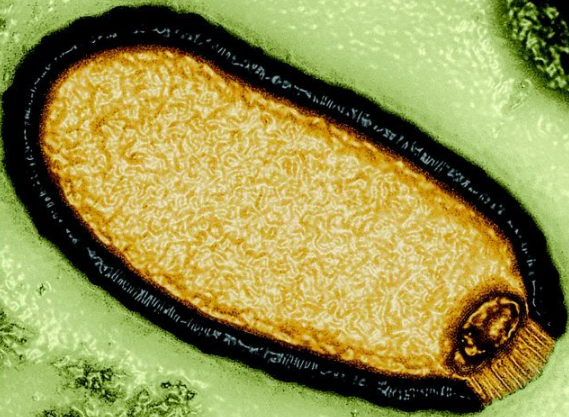 프랑스 엑스마르세유대 연구팀이 영구동토층에서 발견한 바이러스. / 사진=엑스마르세유대