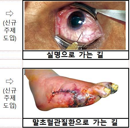 새롭게 도입되는 담뱃갑 경고그림과 문구 / 사진=보건복지부