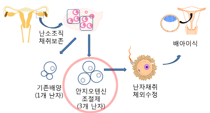시험관시술 성공률 획기적으로 끌어 올리나? 시험관시술 성공률 획기적으로 끌어 올리나?